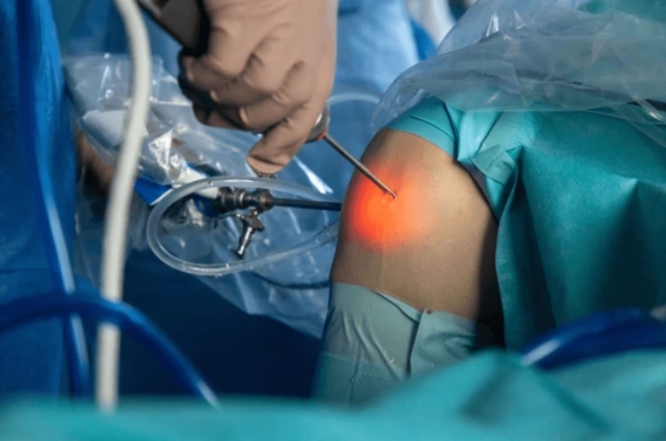 Arthroscopy