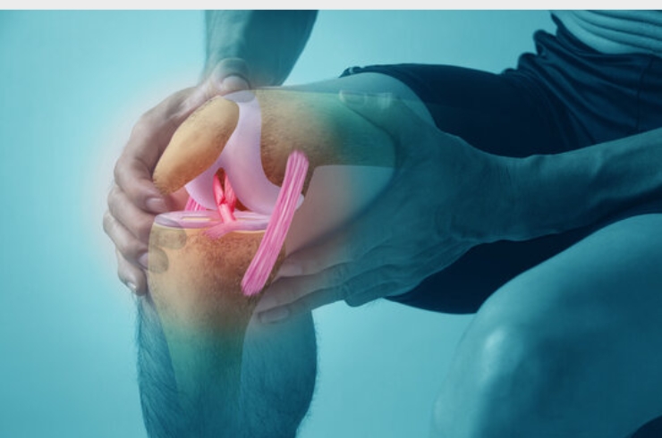 Ligament Injuries (ACL & PCL Tears)