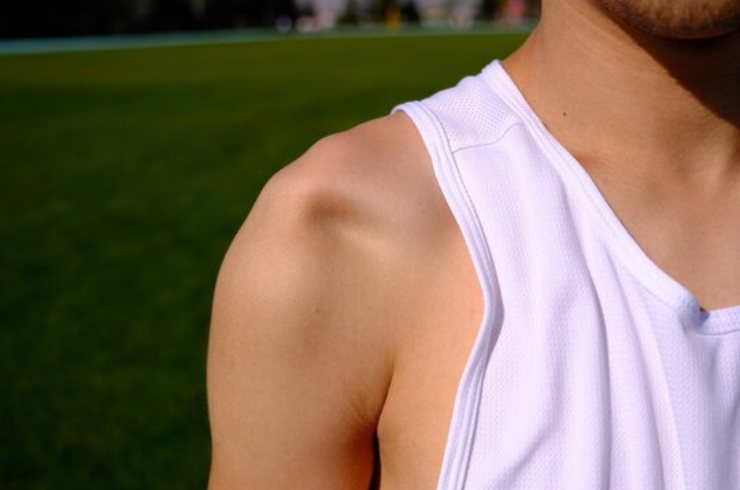 Recurrent Shoulder Dislocations