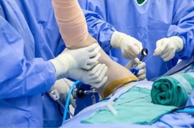 Shoulder Arthroscopy